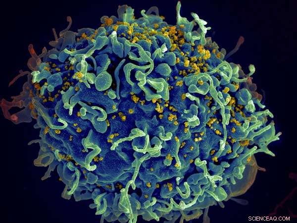 New Study Reveals How Genetics Influence HIV Severity