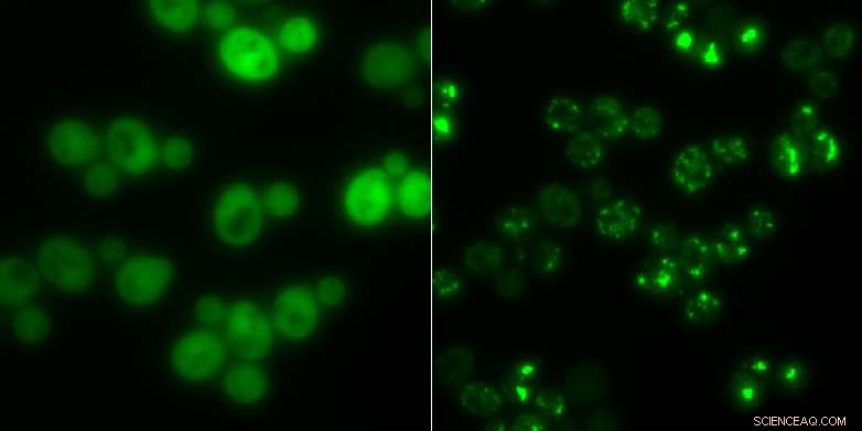 Yeast Protein Clumps Serve as Temporary Storage During Starvation