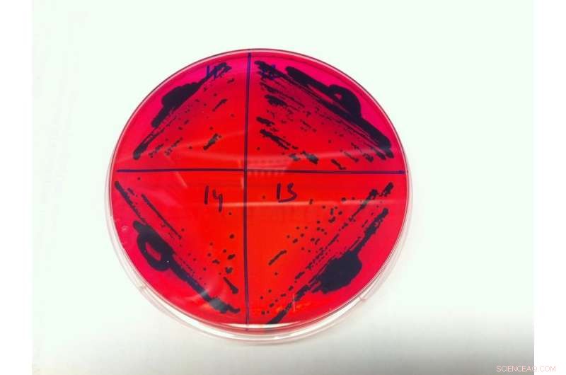 Soil as a Reservoir: How Bacteria Spread Antibiotic Resistance