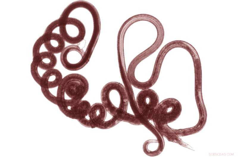 Innovative Defense Mechanism Targets Intestinal Worms, Boosting Global Health