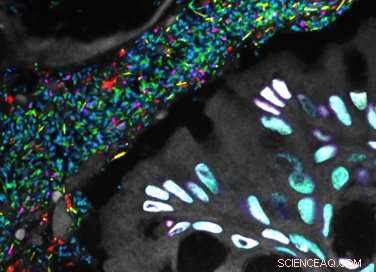 Scientists Map the Gut Microbiome, Revealing Its Complex Microbial Landscape