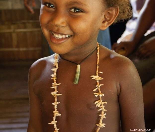 Protecting Giant Tropical Fruit Bats: Partnering with Local Hunters Using Bat Teeth as Currency