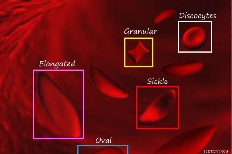 Advanced AI System Automatically Detects Red Blood Cell Shapes with High Accuracy