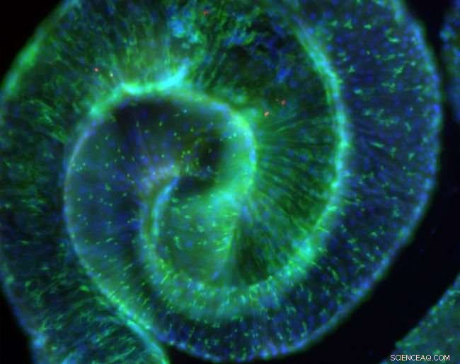 How a Gut Bacterium Triggers Symptoms by Modifying the Fruit Fly Microbiome