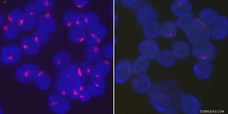 New Study Reveals How Female Immune Cells Silence Their Second X Chromosome
