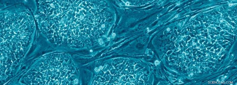 Stem Cells  Decision-Making Unveiled: How They Choose Their Fate
