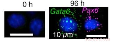 Stem Cells  Decision-Making Unveiled: How They Choose Their Fate