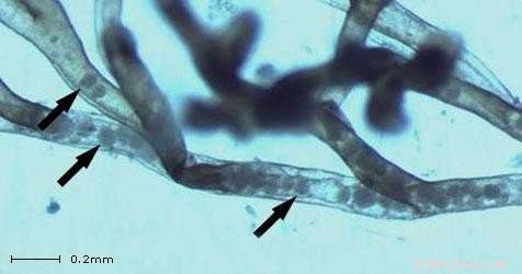 Tracking the Parasite Threatening Freshwater Fish Populations