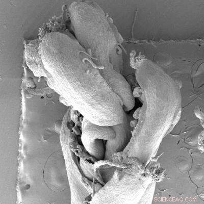 The Role of CRABS CLAW in Suppressing TORNADO2 During Plant Development