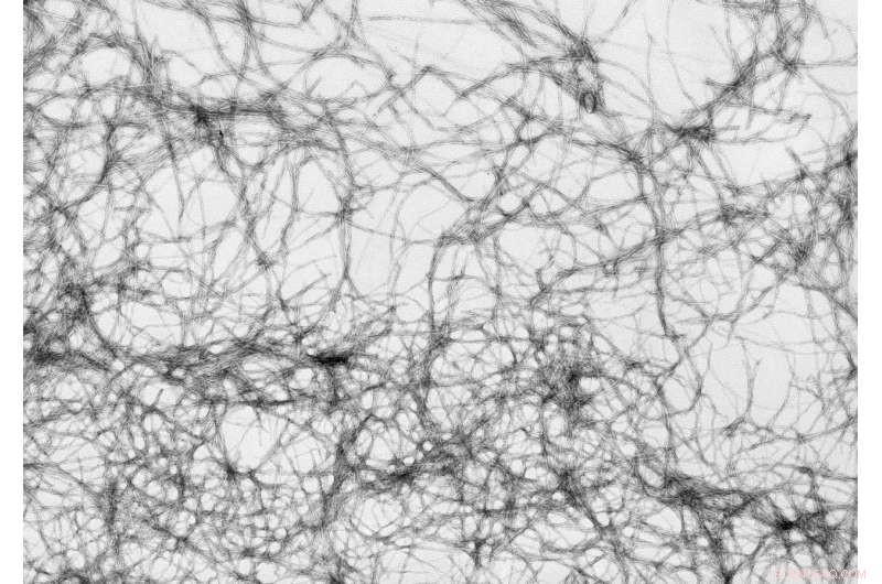 New Protein Discovery Offers Hope in Fighting Antibiotic Resistance