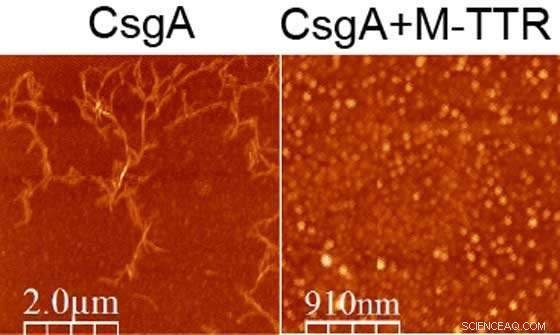 New Protein Discovery Offers Hope in Fighting Antibiotic Resistance