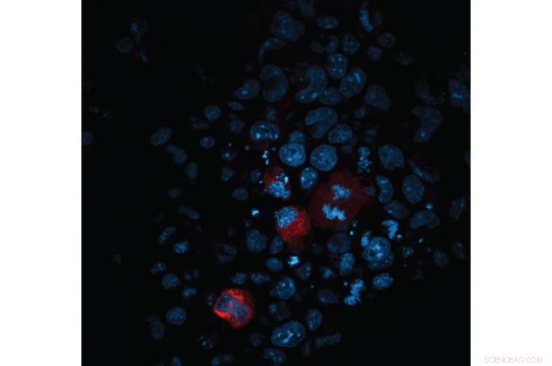 Preventing Genetic Instability in Early Development