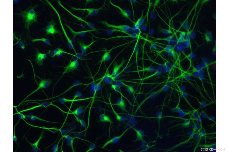 Enhancing Neuron Production: Discovery of a New Stem Cell Identity Modulator