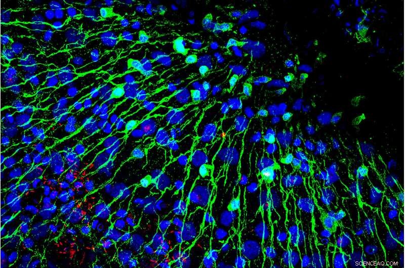 Bacteria: The Natural Pacemaker Regulating Intestinal Motility