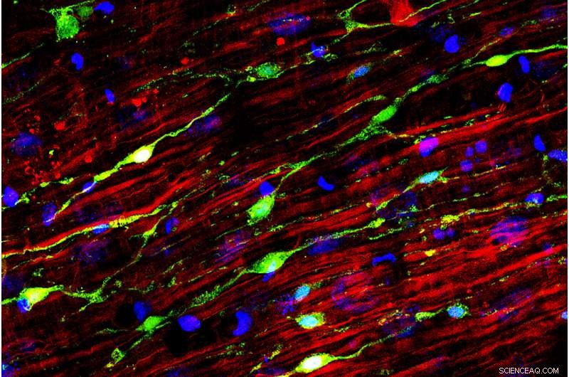 Bacteria: The Natural Pacemaker Regulating Intestinal Motility