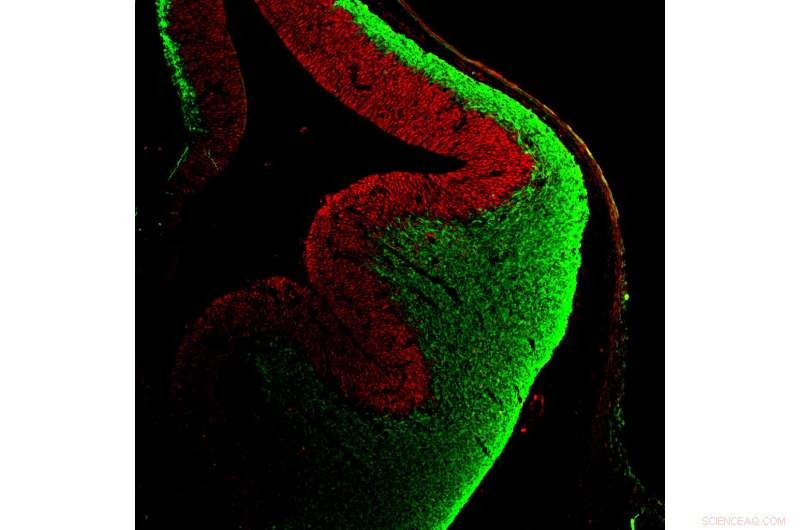 Ryk Protein Needs a Chaperone: Why It Matters in Neuroscience