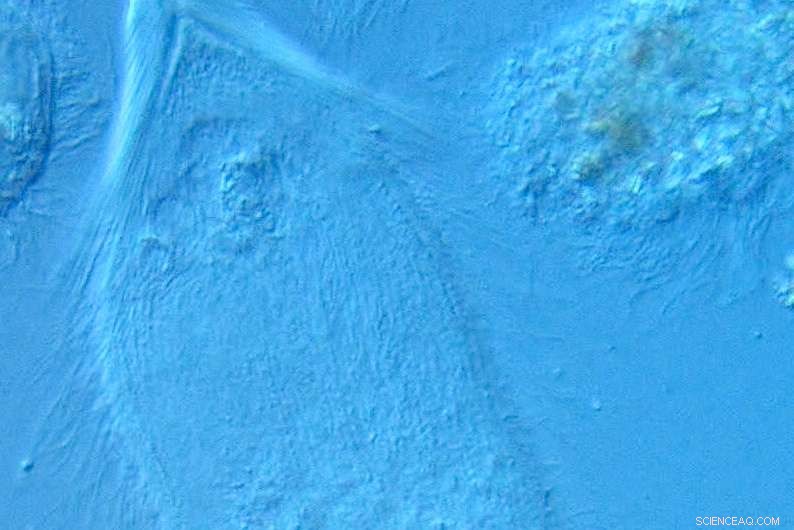 New Termite Gut Microbes Named After Rush: A Study of Hairy, Rhythmic Bacteria