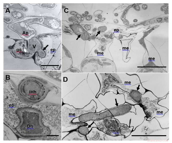 Host Immune Response Triggers Abnormal Hyphae Formation in Plant Pathogenic Fungus