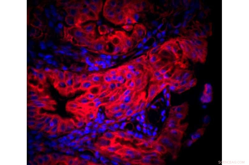 Scientists Uncover H. pylori s Novel Mitochondrial Targeting Mechanism