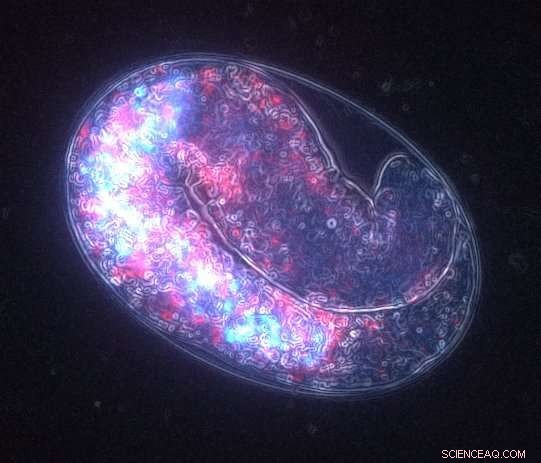 Maternal Age Influences Genetic Similarity in Twins