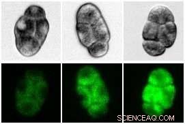 Maternal Age Influences Genetic Similarity in Twins