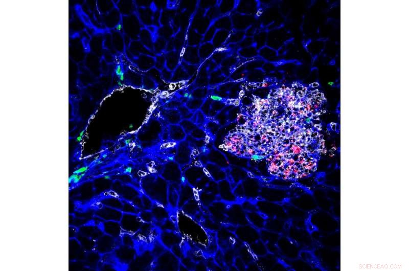 Unveiling Listeria s Dormant Survival: How It Hides Inside Cells