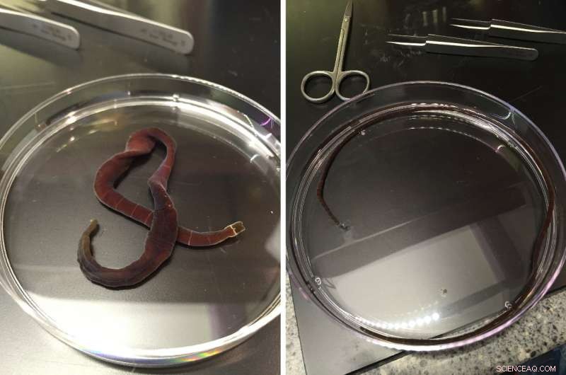 Worm Genomes Reveal Human Connections to Unexpected Species