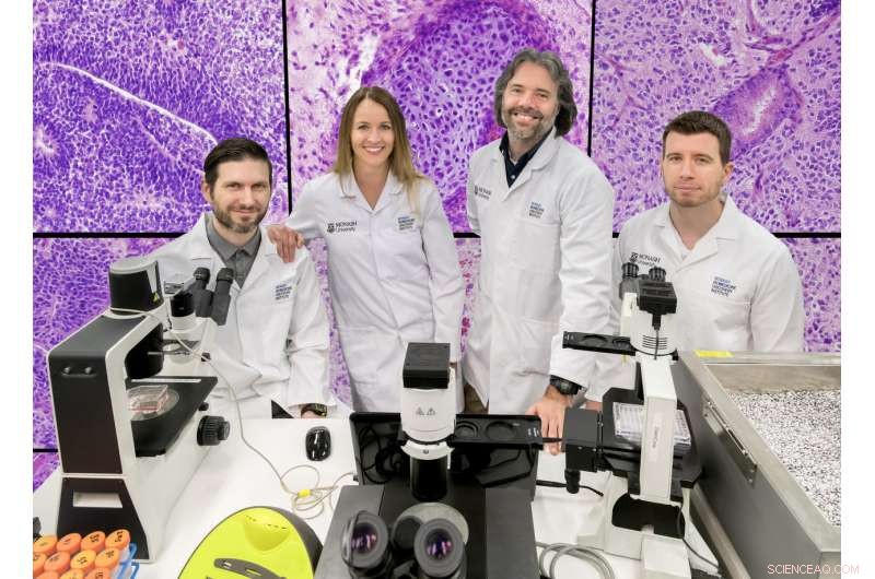 Monash University Breaks Decade-Long Stem Cell Enigma with New Research Findings