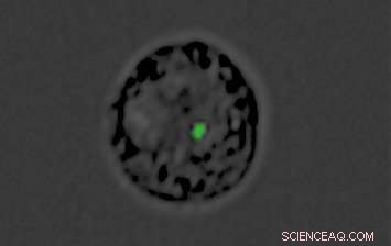 Malaria’s Tactics: How the Parasite Evades the Immune System