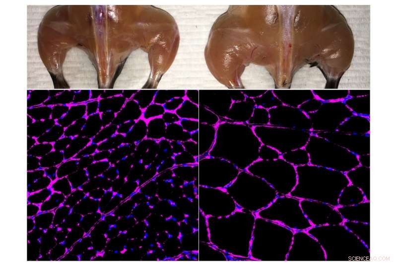 Engineered CRISPR Offers Epigenetic Treatment for Diabetes, Kidney Disease, and Muscular Dystrophy