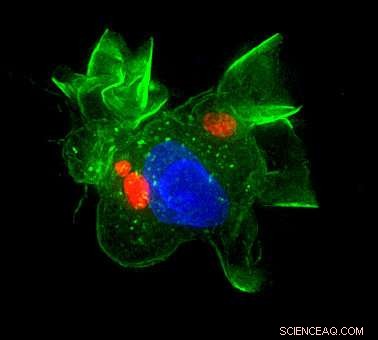 Toxoplasmosis: How the Parasite Hijacks Immune Cells to Cross the Blood‑Brain Barrier