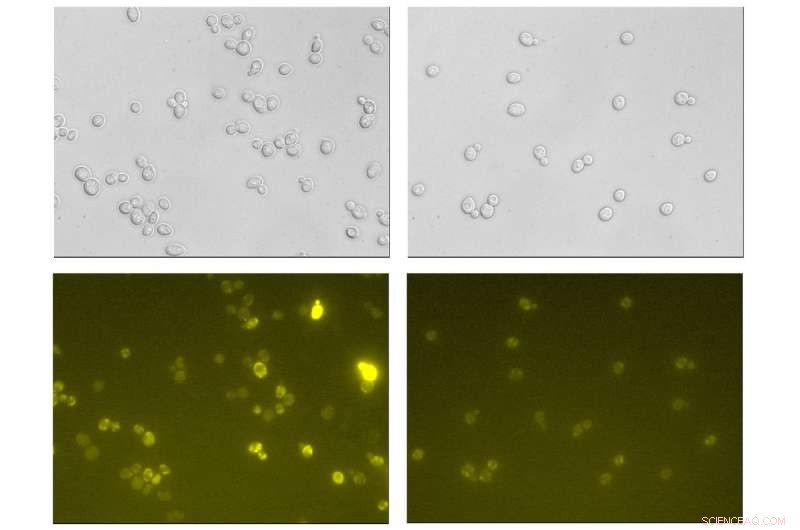Engineering Yeast to Overcome ROS and Produce Protein‑Based Pharmaceuticals