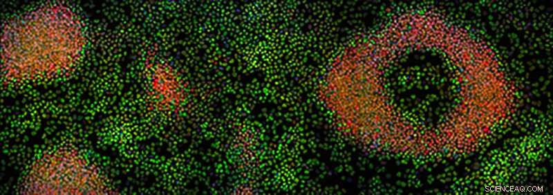 New Proteins Found to Maintain Stem Cells  Undifferentiated State