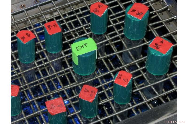 Bacterial Metabolic Control: Adapting to Nutrient Changes