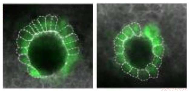 Maternal Genes Direct Embryonic Patterning and Left-Right Development