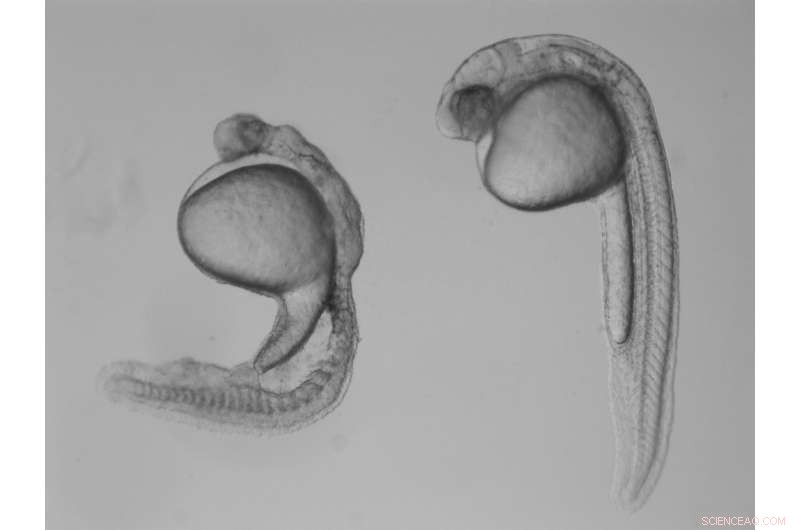Maternal Genes Direct Embryonic Patterning and Left-Right Development