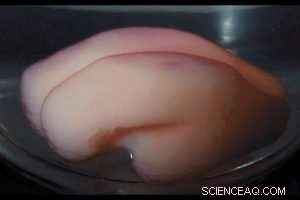 Morphogenesis: Understanding How Living Forms Develop