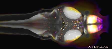 Neuropeptide Insights: Zebrafish Reveal Complex Sleep Mechanisms