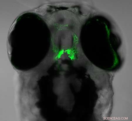 Neuropeptide Insights: Zebrafish Reveal Complex Sleep Mechanisms