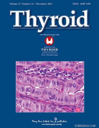 New Research Unveils How Thyroid Hormones Govern Seasonal Reproduction in Mammals