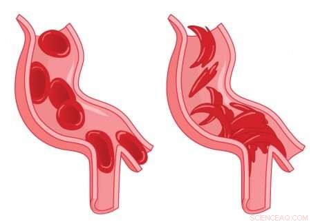 Deer Genomics Reveal Clues on Malaria Resistance and Sickle Cell Trait