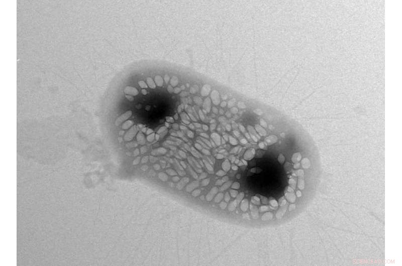 Engineered Bacteria Reflect Sonar Signals, Revolutionizing Ultrasound Imaging