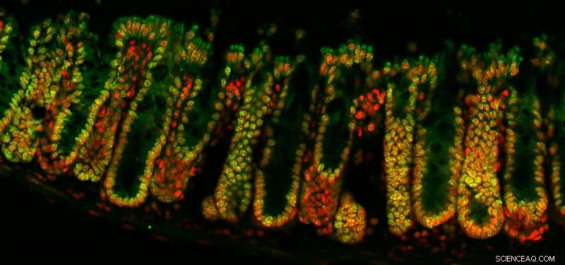 How Beneficial Bacteria Regulate Human Gene Expression