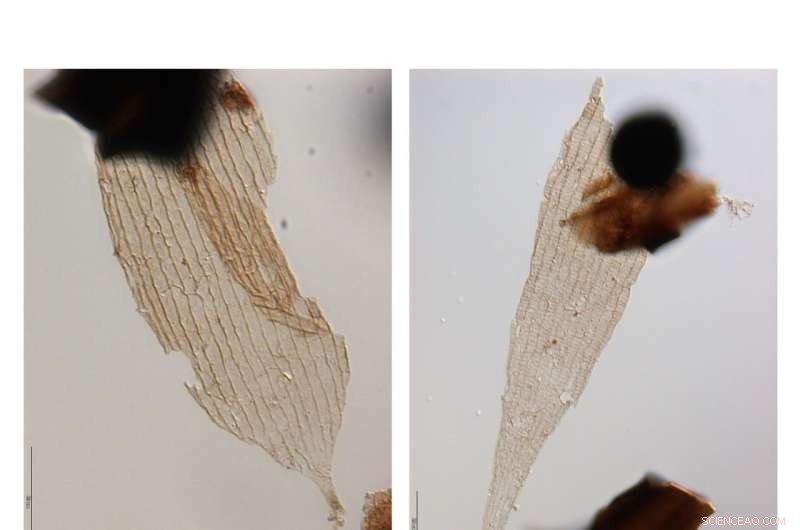 Scientists Discover Evolutionary Answers in Pond Scum