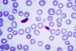 UC San Diego Researchers Map Druggable Genetic Targets in Evolving Malaria Parasite
