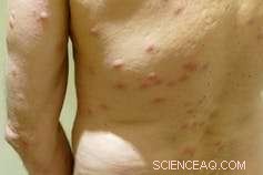 The Complete Guide to Bed Bugs: Facts, Prevention, and Solutions