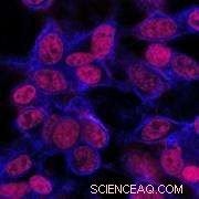 Nano-Scale Drug Delivery Revolutionizes Chemotherapy Outcomes