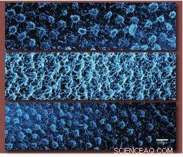 Targeted Cancer Therapy: Hydrogel Nanoparticles Deliver Precision Treatment