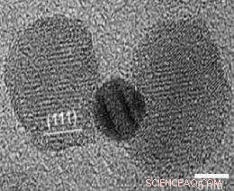 Gold Nanoparticles Target and Destroy Cancer Cells with Precision