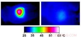Gold Nanoparticles Offer Precision Photothermal Therapy for Cancer